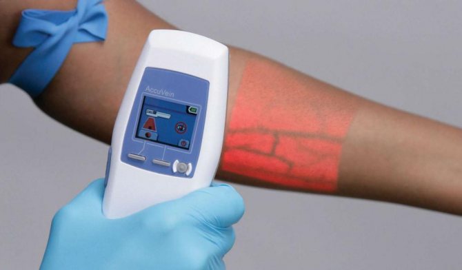dispositivi medici con raggi infrarossi