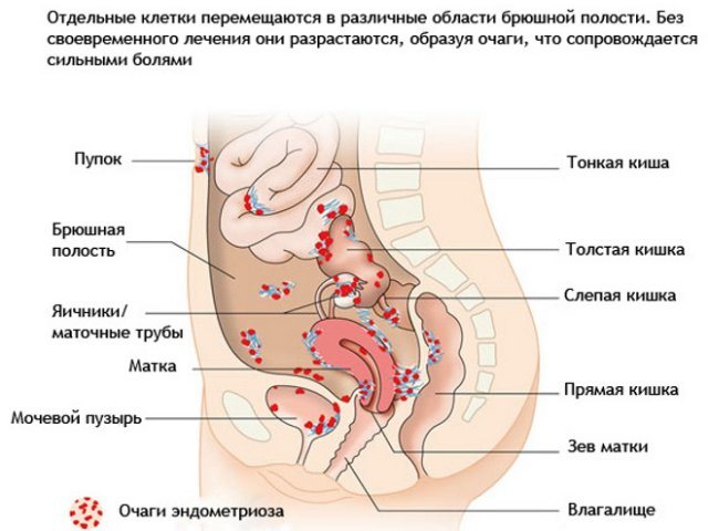 Tira de la parte inferior del abdomen y duele el pecho: causas, posibles enfermedades